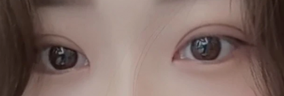다이아트임 전후사진