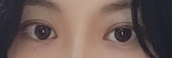 다이아트임 전후사진